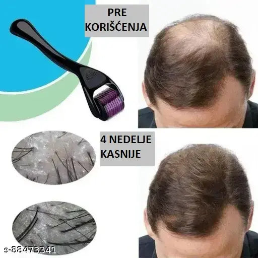 Derma Roller™ Roler Za Negu Tela