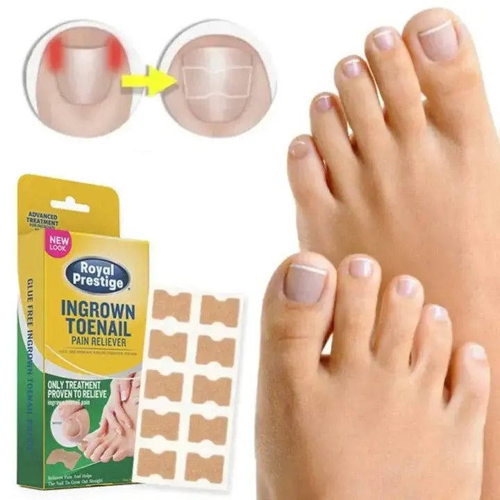 Flasteri protiv urastanja noktiju 100kom.