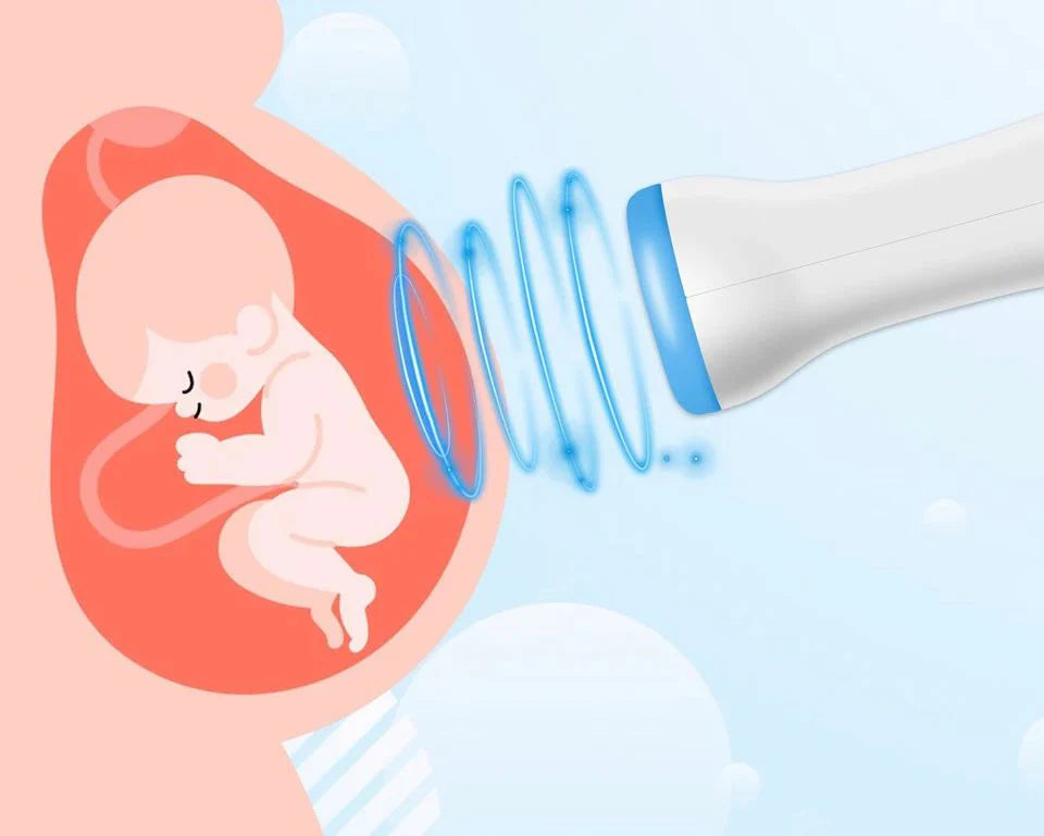 FETAL DOPPLER(BABY WATCHER) KUĆNI ULTRAZVUK